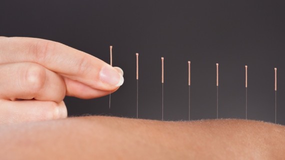 benefits-of-electro-acupuncture-diversified-health